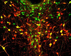 Одиночество влияет на клеточную структуру мозга, укрепляя связи между нейронам